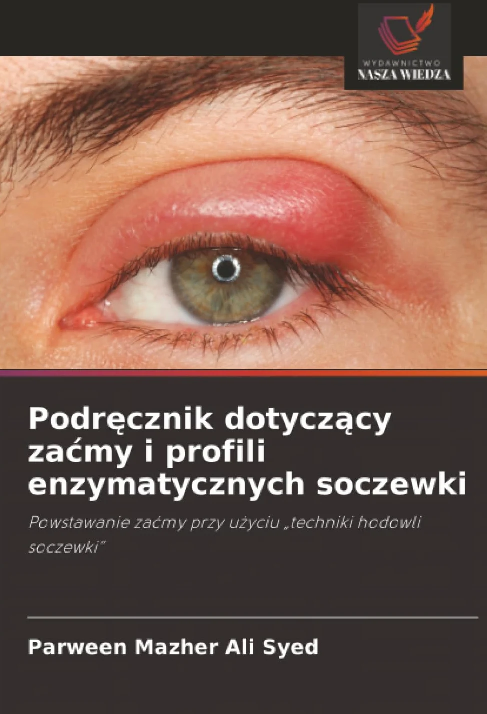 Podr¿cznik dotycz¿cy za¿my i profili enzymatycznych soczewki: Powstawanie za¿my przy u¿yciu "techniki hodowli soczewki"