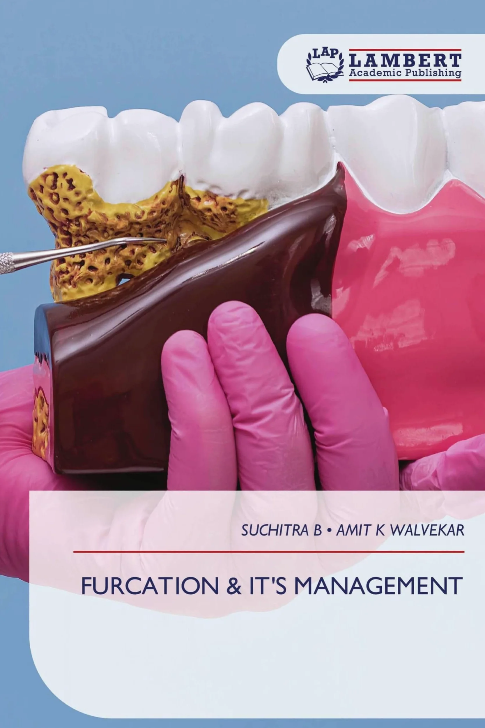 FURCATION & IT'S MANAGEMENT