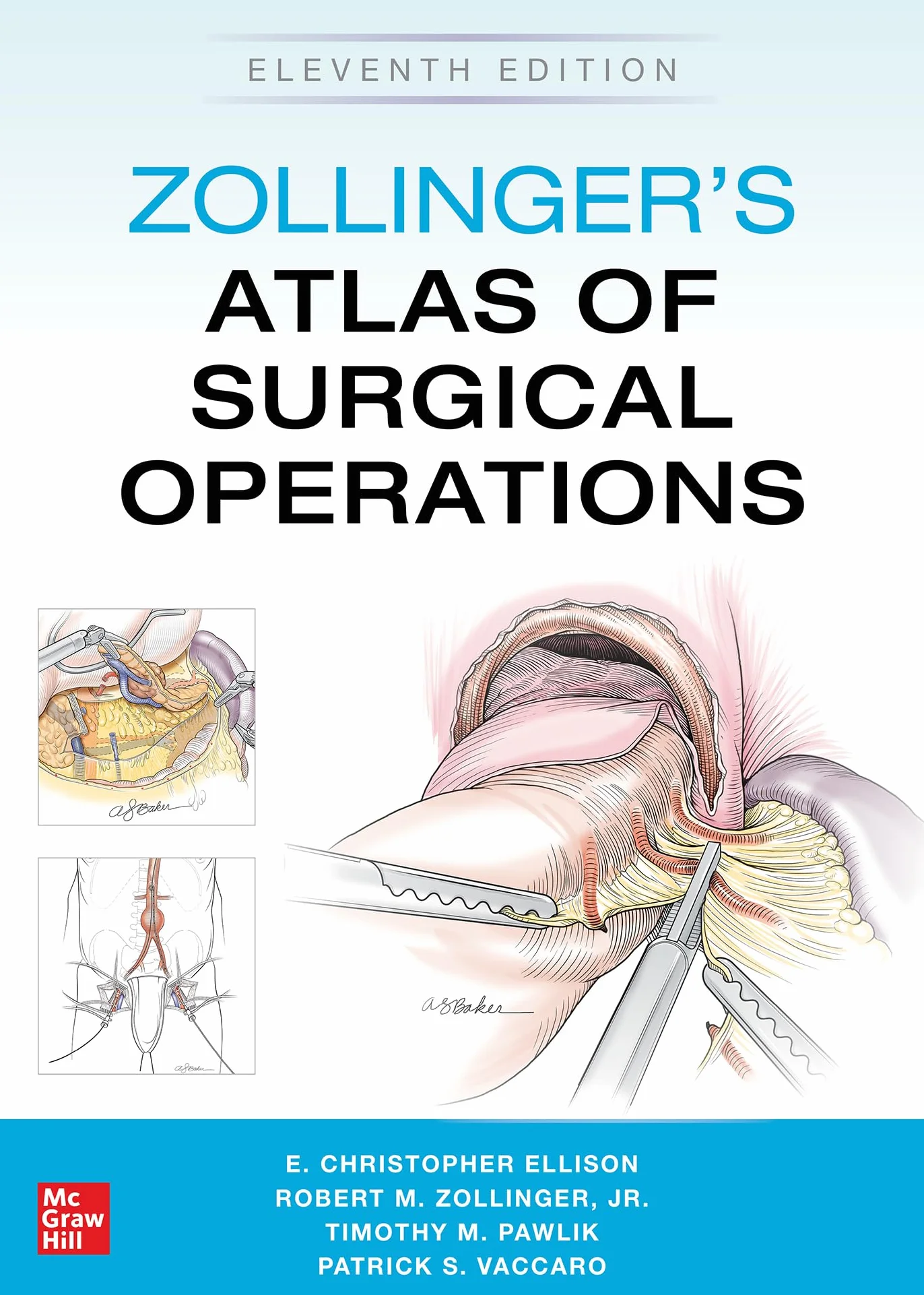 Zollinger's Atlas of Surgical Operations, Eleventh Edition