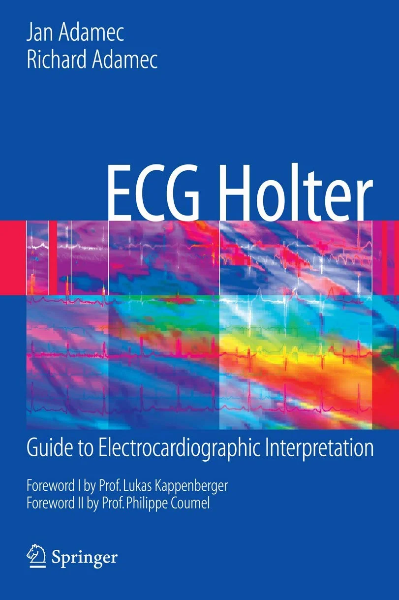 ECG Holter: Guide to Electrocardiographic Interpretation