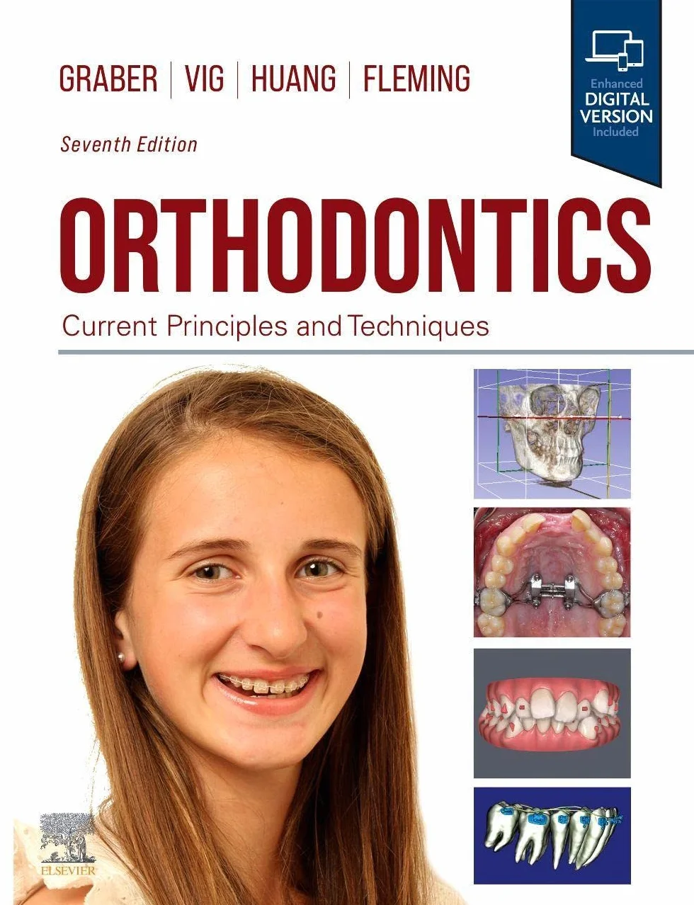 Orthodontics: Current Principles and Techniques
