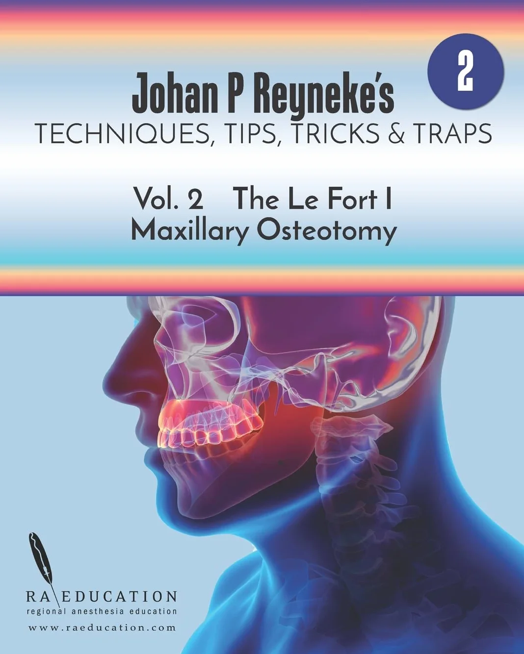 Johan P. Reyneke’s Techniques, Tips, Tricks & Traps Vol 2:: The Le Fort I Maxillary Osteotomy