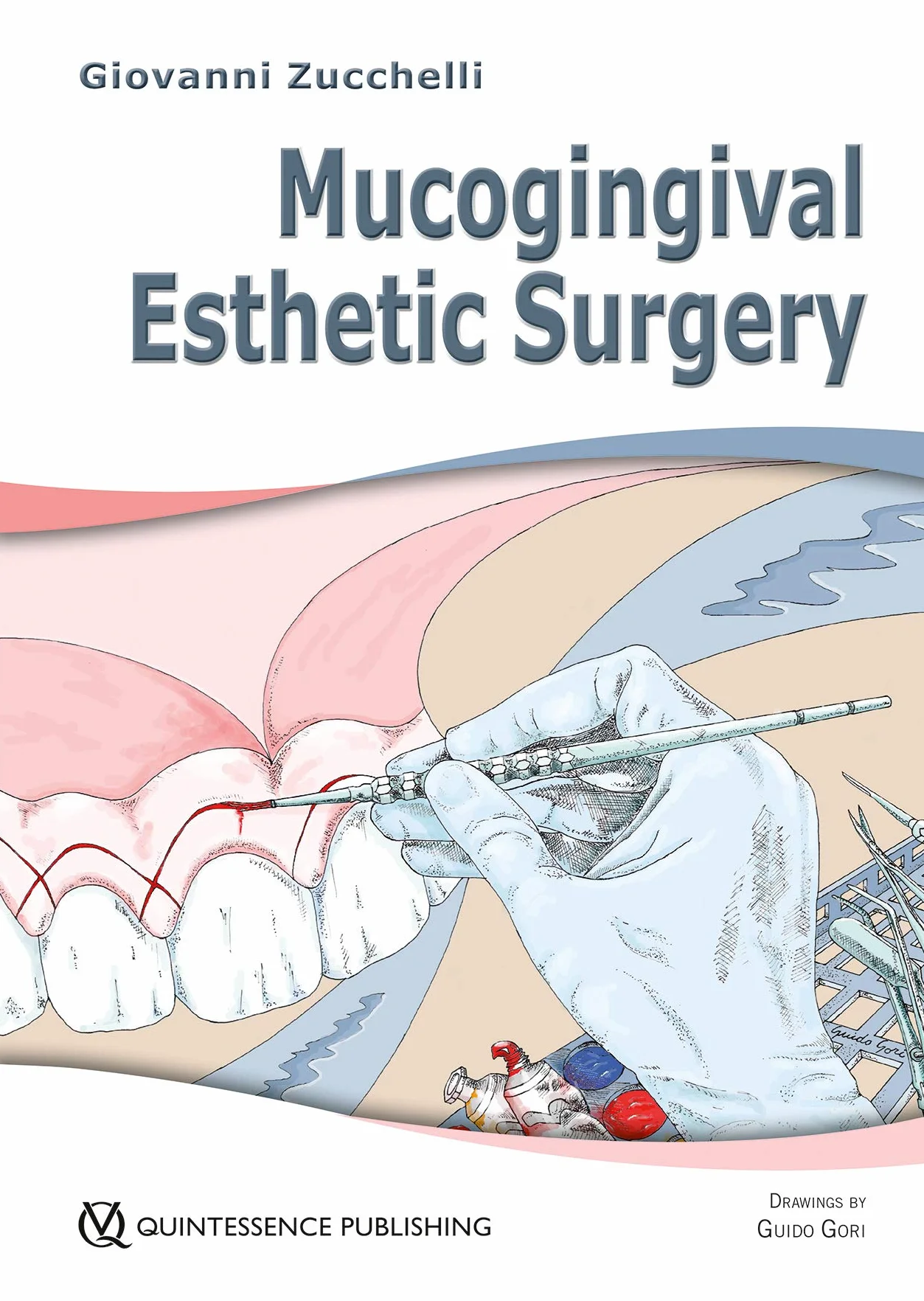Mucogingival esthetic surgery