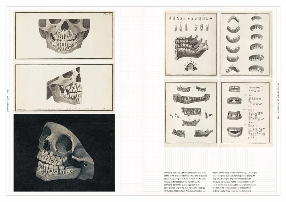 Smile Stealers: The Fine and Foul Art of Dentistry