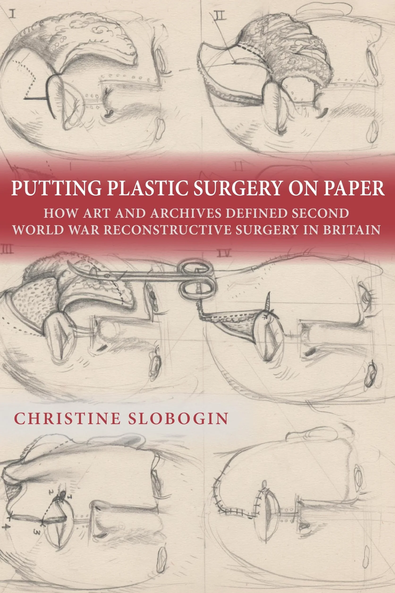 Reconstructive Surgery in Britain: Plastic Surgery on Paper, Art and Archives in World War II