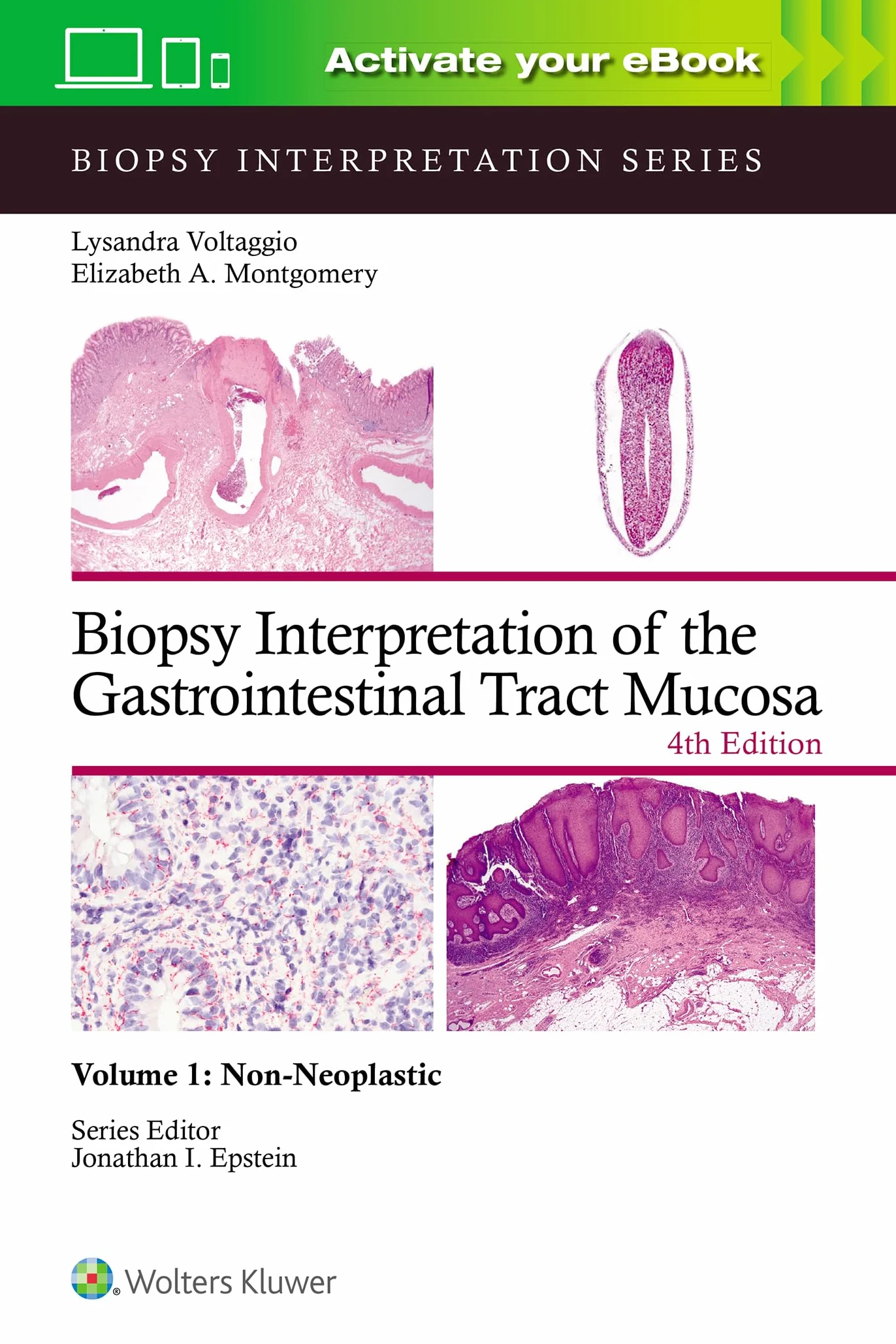 Biopsy Interpretation of the Gastrointestinal Tract Mucosa Volume 1: Non-Neoplastic: Print + eBook with Multimedia Volume 1