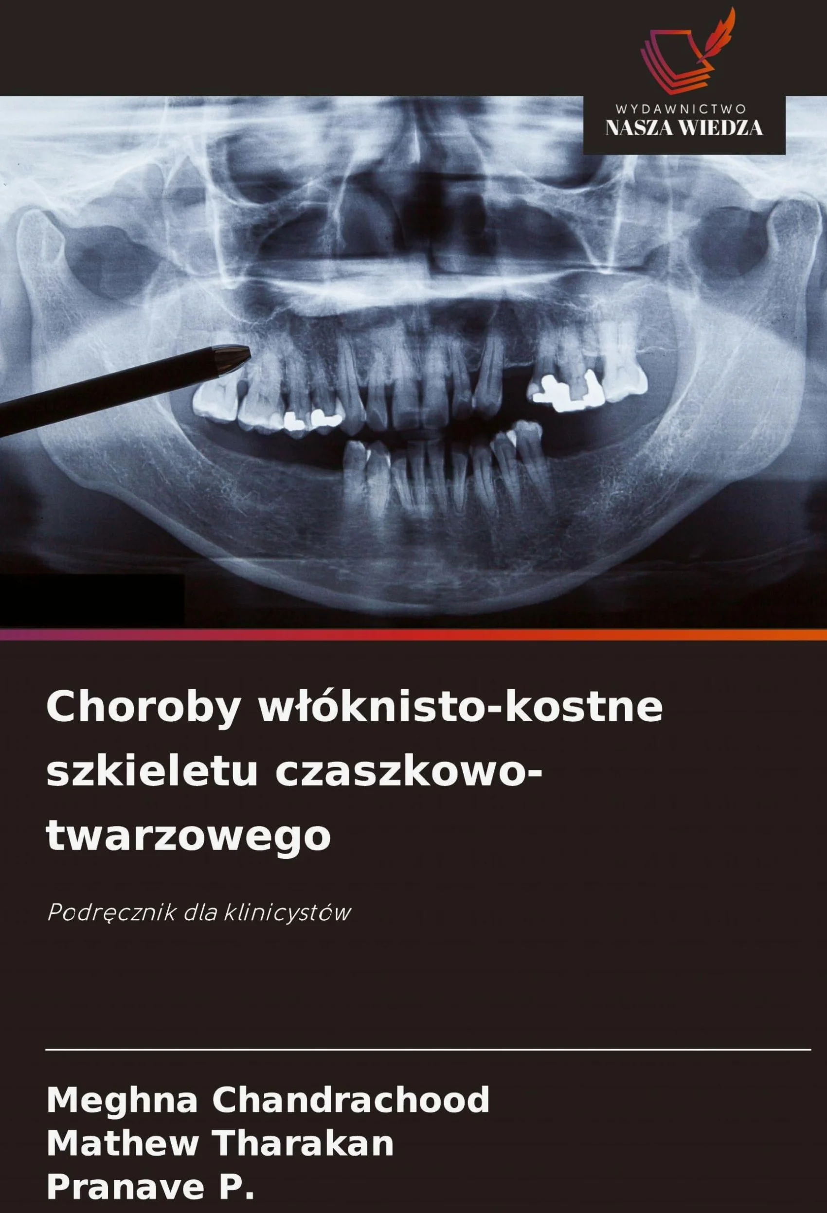 Choroby w¿óknisto-kostne szkieletu czaszkowo-twarzowego: Podr¿cznik dla klinicystów