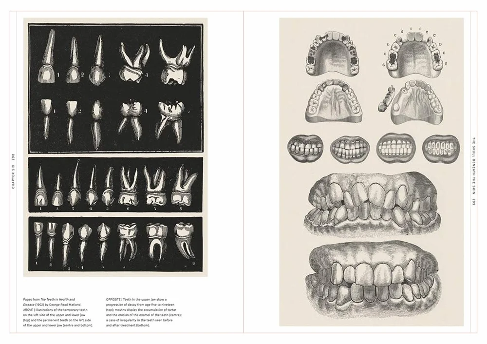 Smile Stealers: The Fine and Foul Art of Dentistry