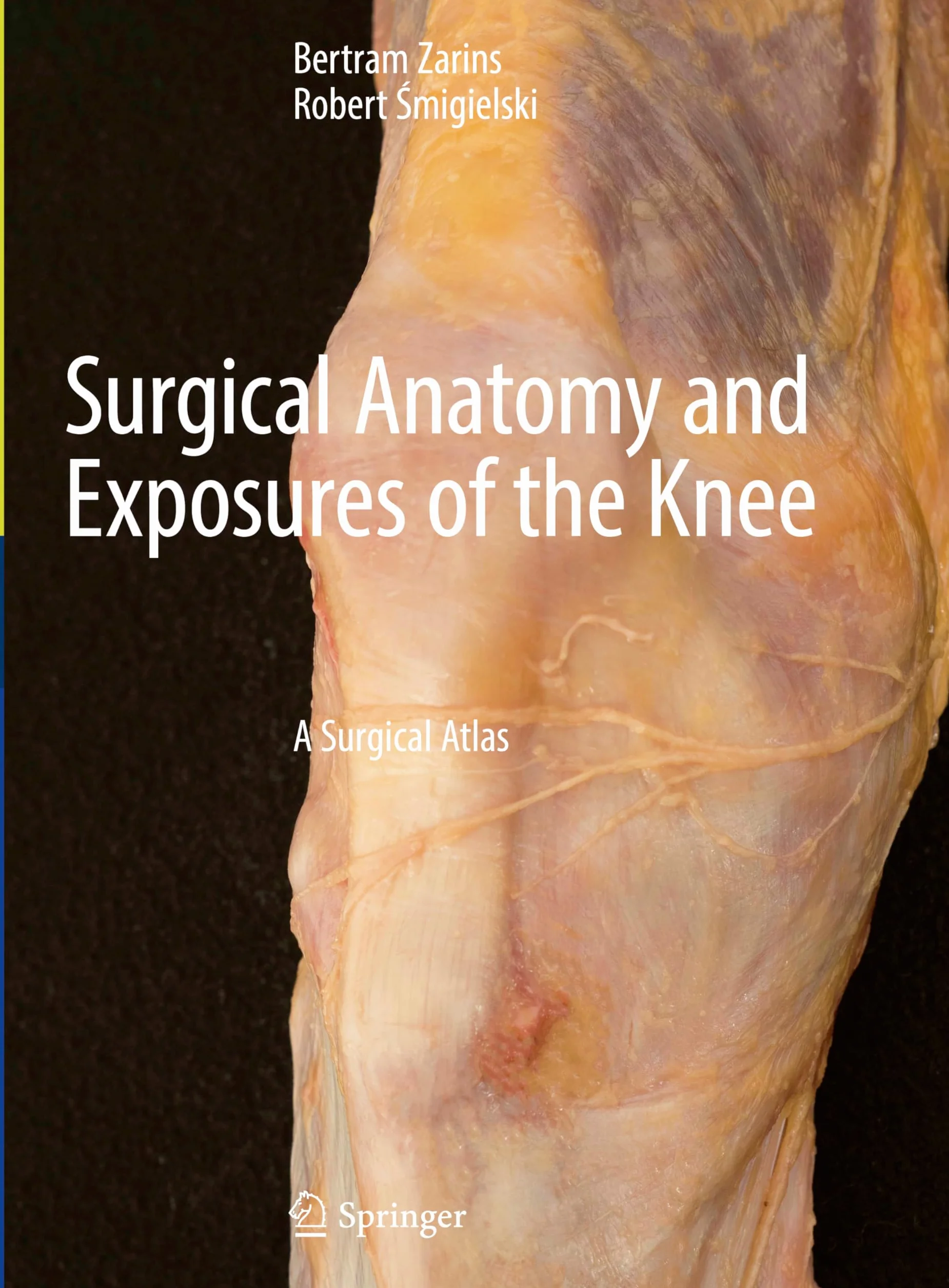 Surgical Anatomy and Exposures of the Knee: A Surgical Atlas