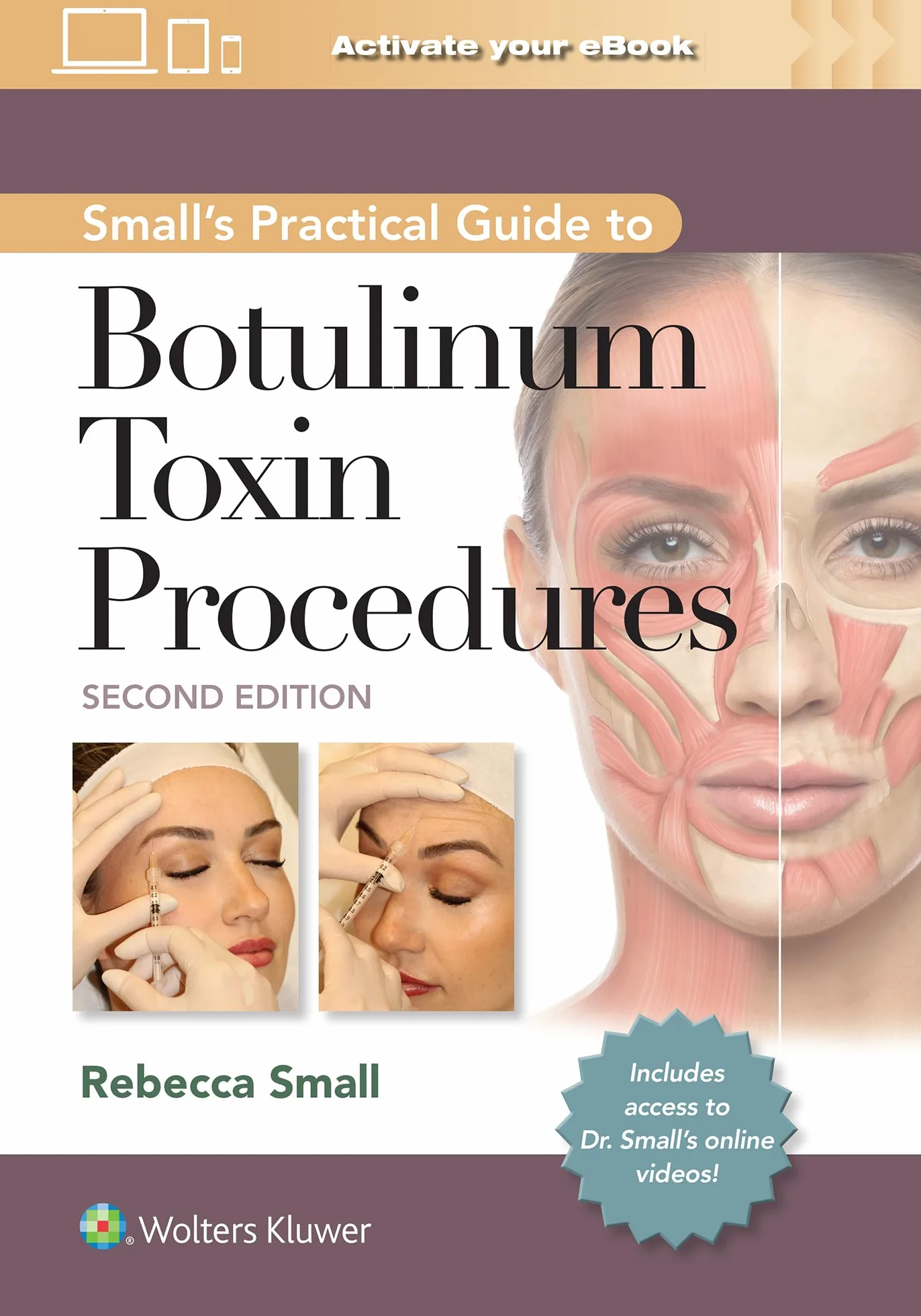 Small's Practical Guide to Botulinum Toxin Procedures: Print + eBook with Multimedia