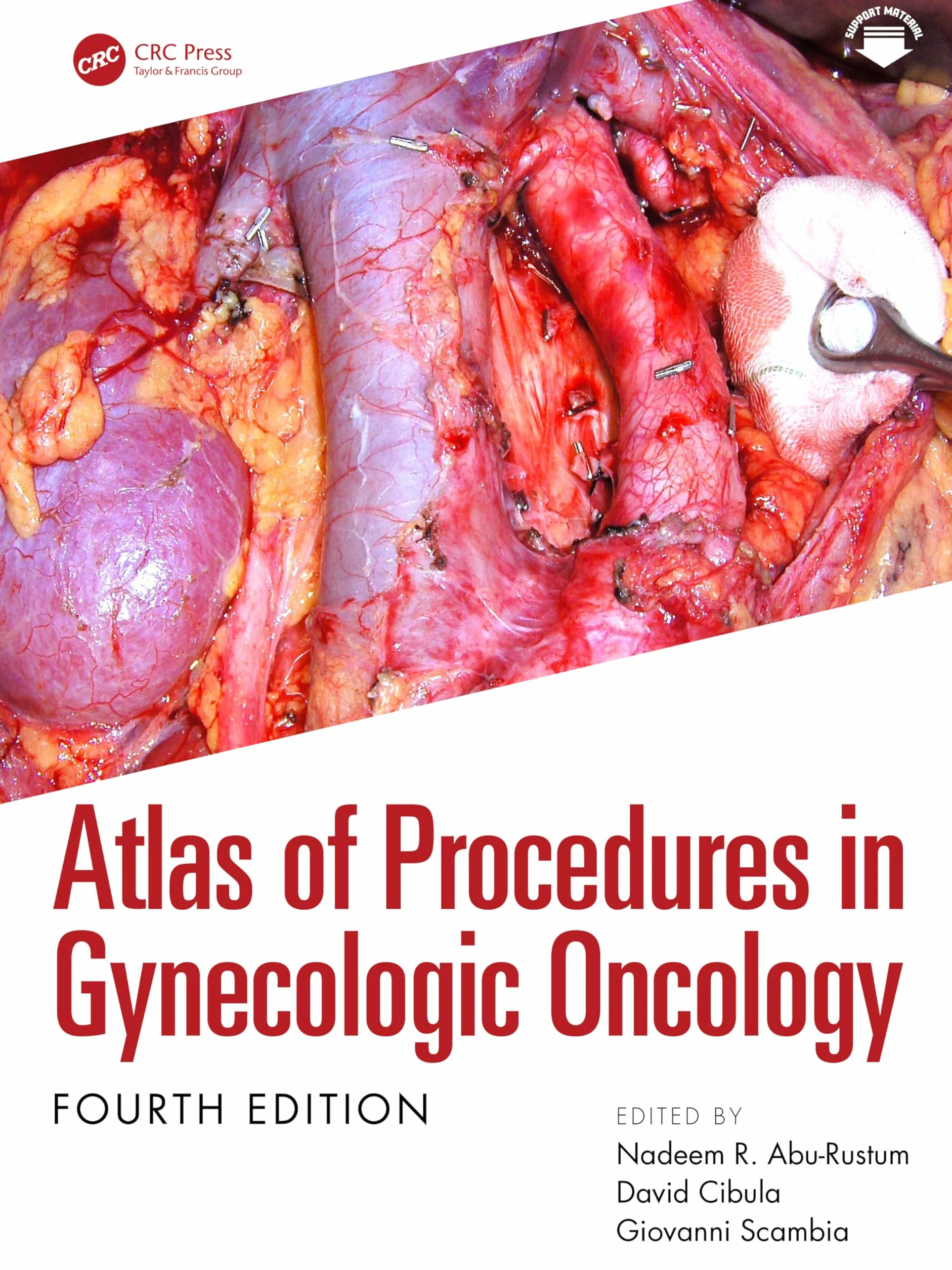Atlas of Procedures in Gynecologic Oncology