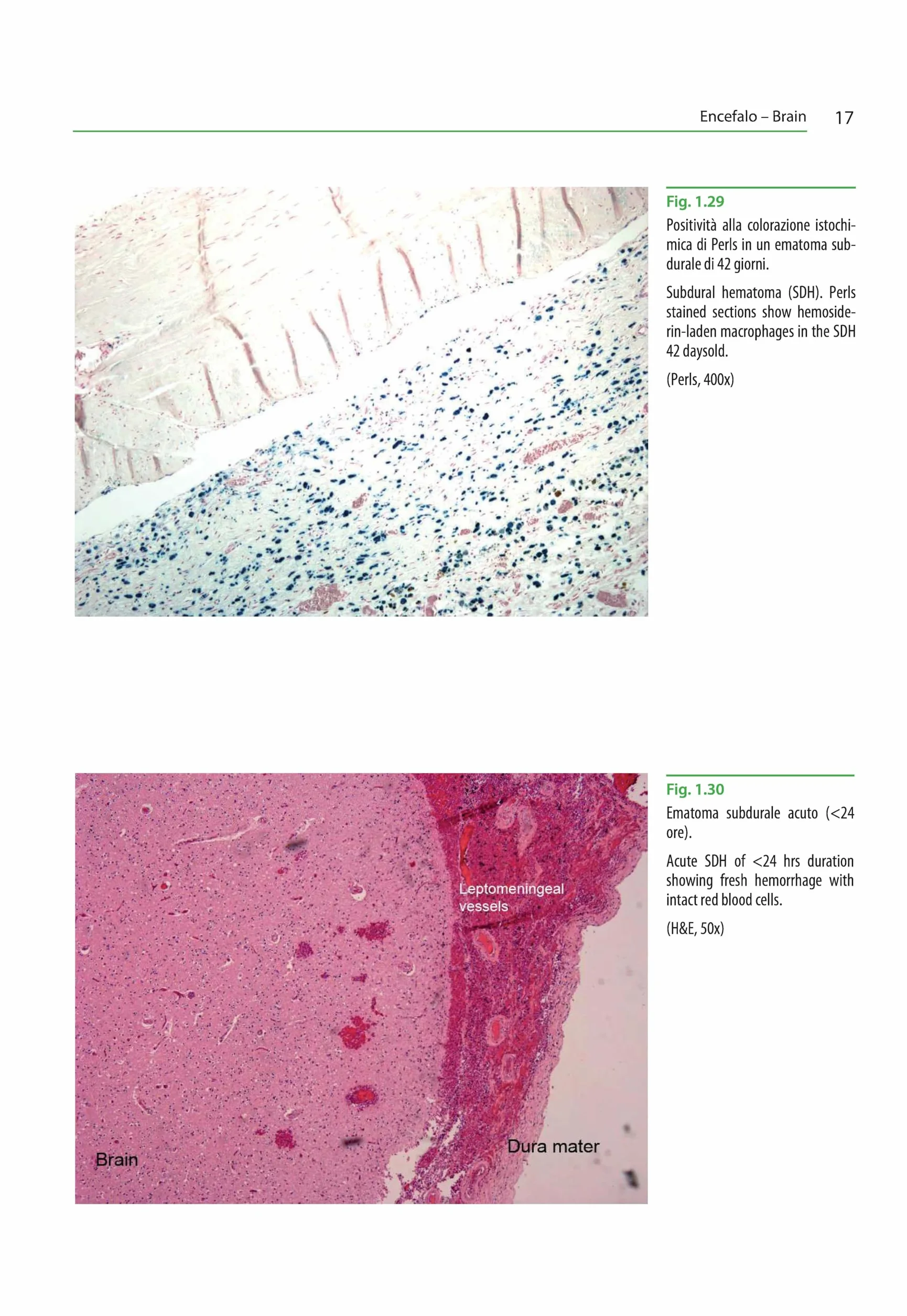 Atlante di istopatologia forense-Atlas of forensic histopathology. Ediz. bilingue
