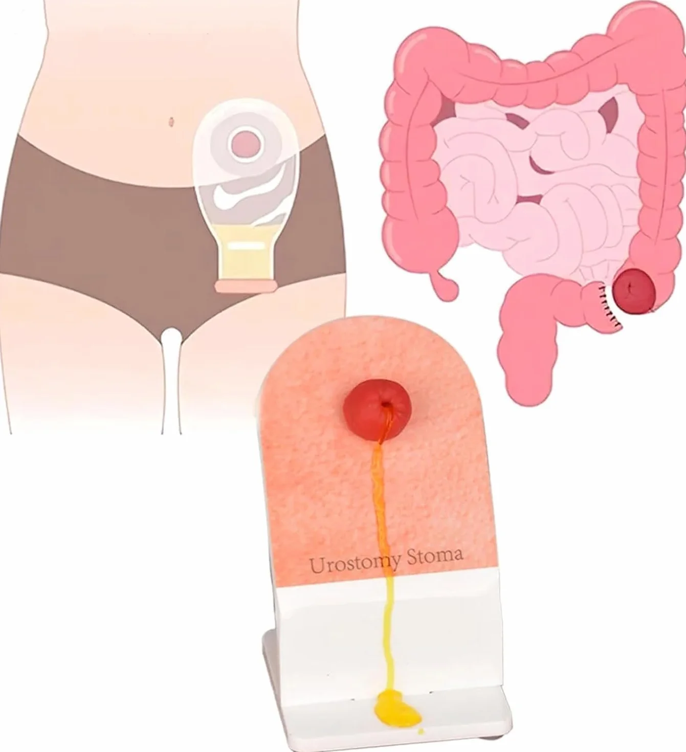 Model treningowy do pielęgnacji stomii, realistyczny symulator pielęgniarstwa stomijnego, do praktyki opieki nad ileostomią przetoki, edukacji studentów medycyny, demonstracji klinicznej, 4