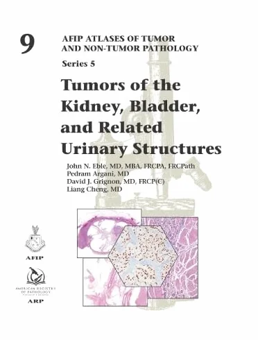 Tumors of the Kidney, Bladder, and Related Urinary Structures