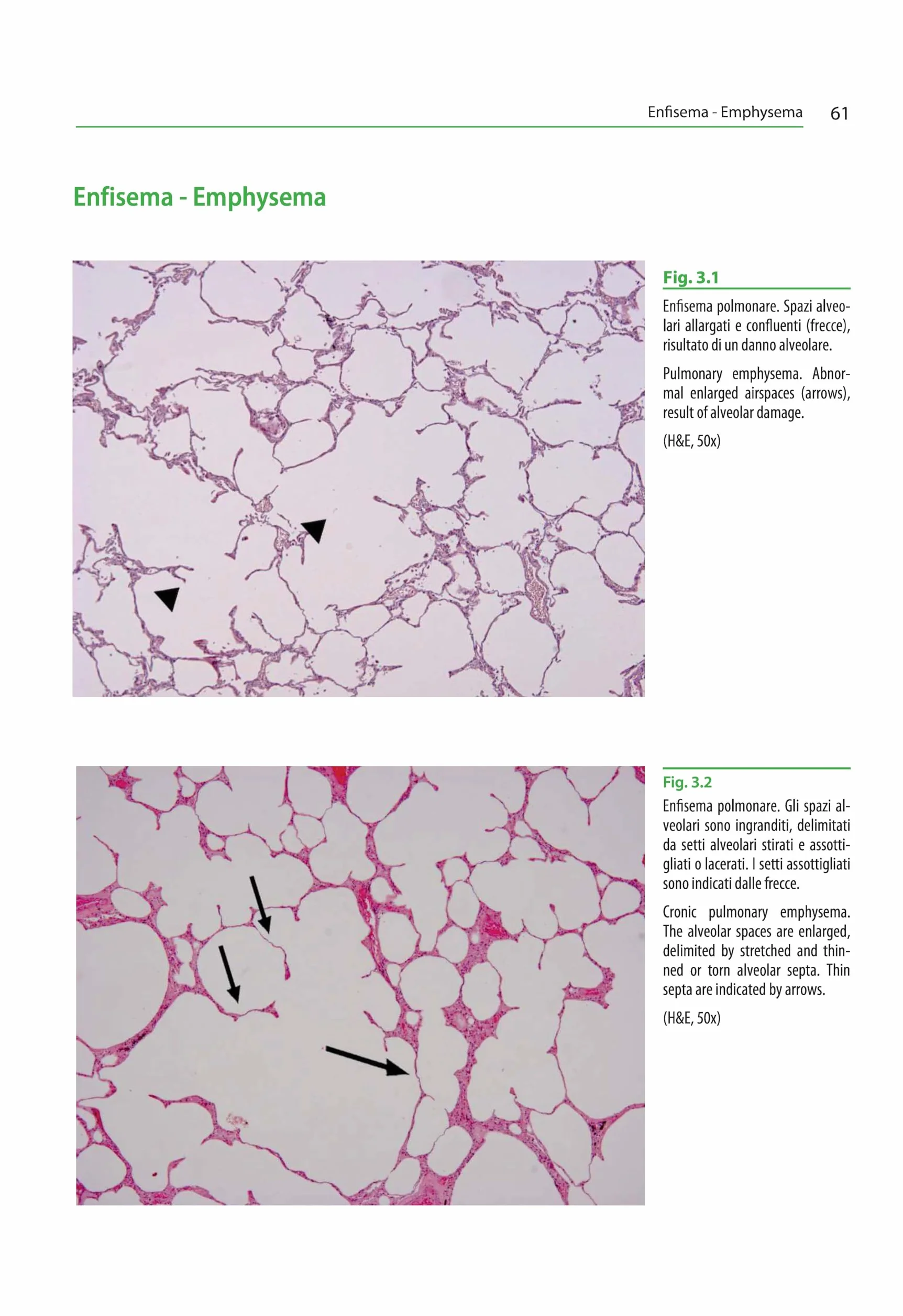 Atlante di istopatologia forense-Atlas of forensic histopathology. Ediz. bilingue