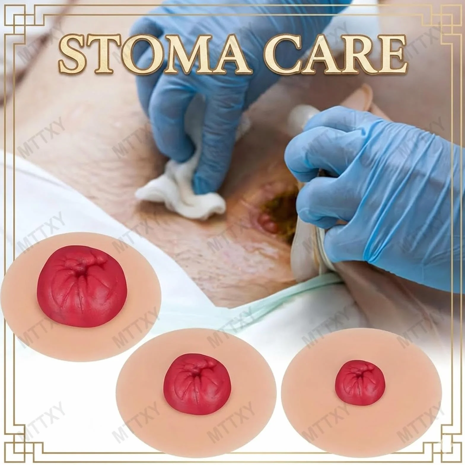 Zestaw 9 Samoprzylepnych Symulatorów Stomii, Realistyczny Model Treningowy do Pielęgnacji Stomii, Medyczny Zestaw Edukacyjny dla Pielęgniarstwa, Kolostomii, Ileostomii i Urostomii