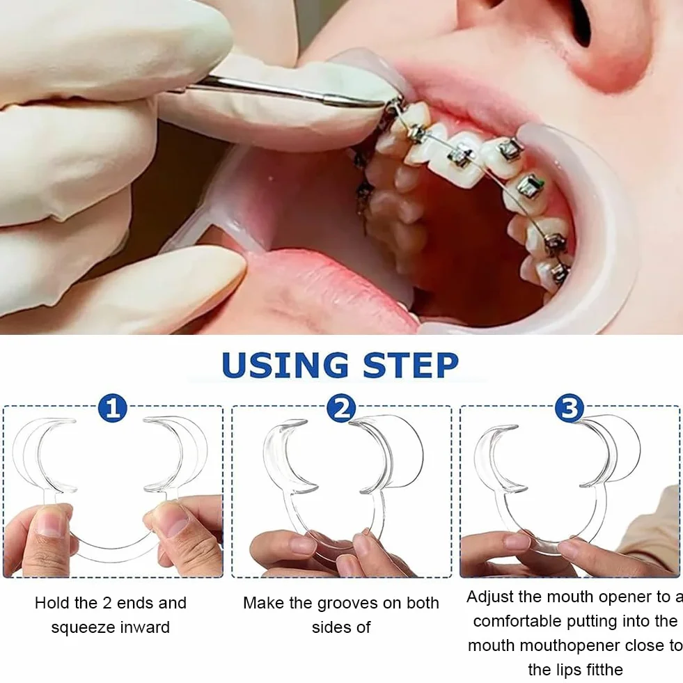 Otwieracz do ust dentystyczny w kształcie litery C wybielanie zębów zestaw dla dorosłych