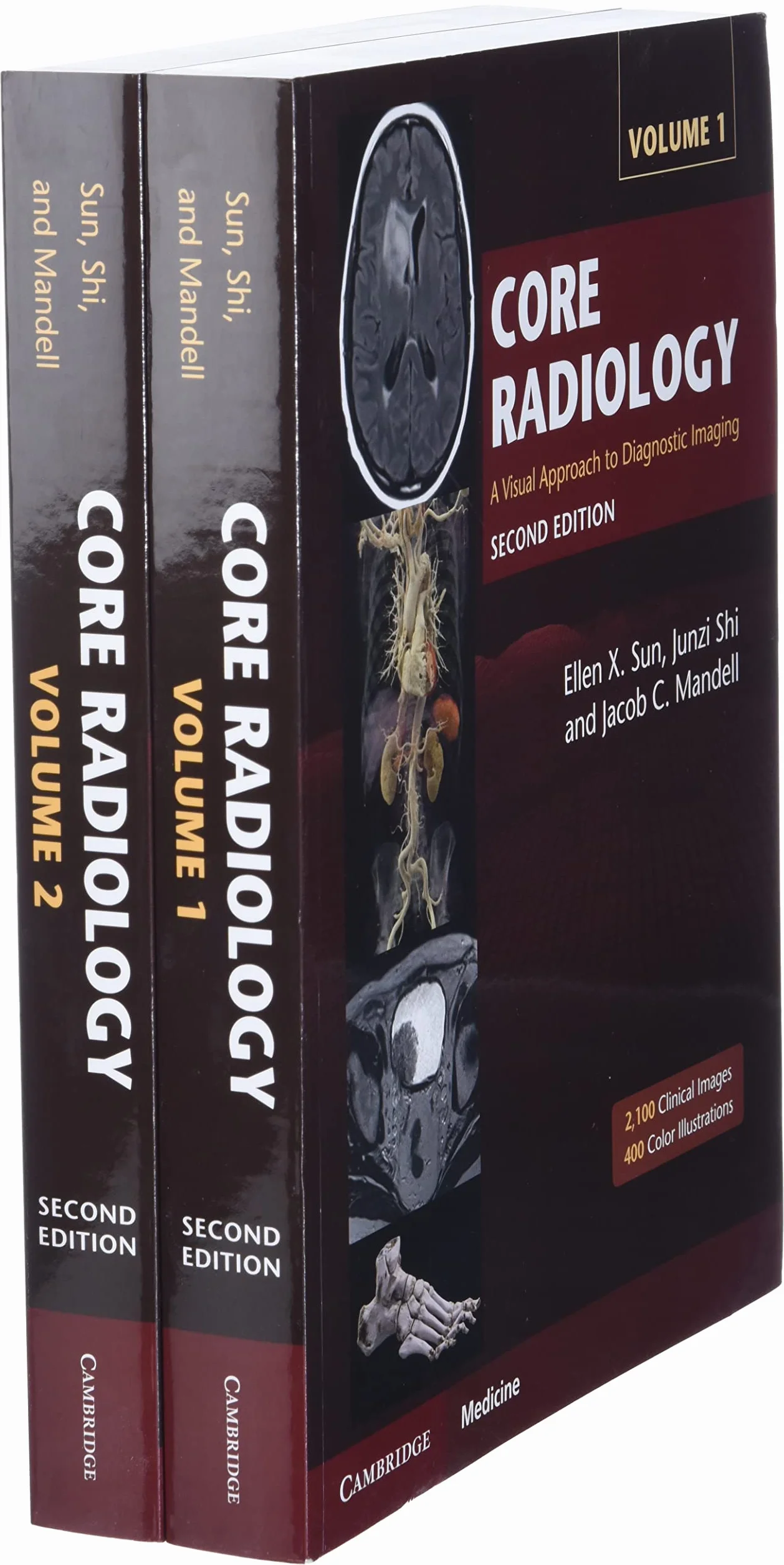 Core Radiology: A Visual Approach to Diagnostic Imaging