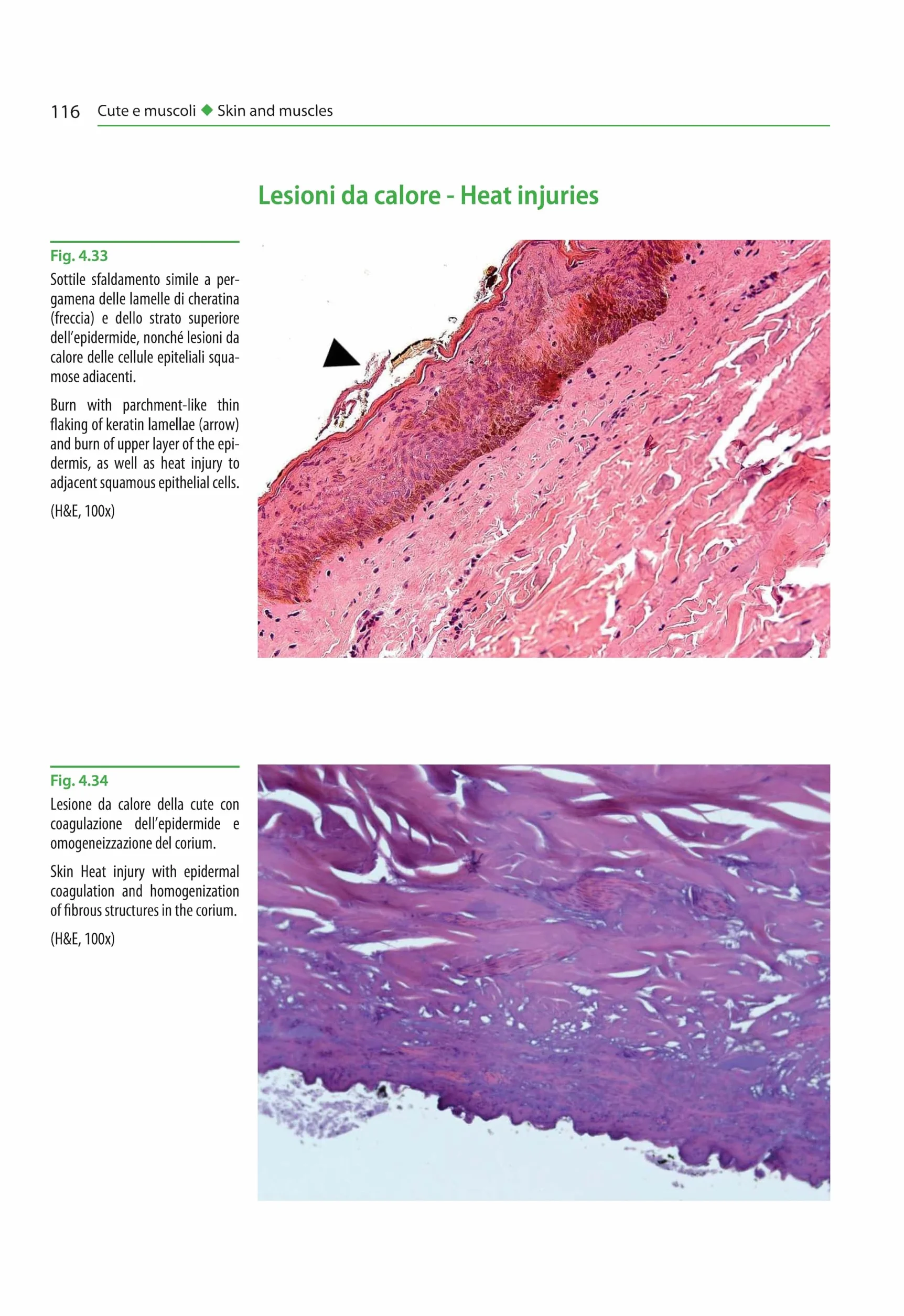 Atlante di istopatologia forense-Atlas of forensic histopathology. Ediz. bilingue