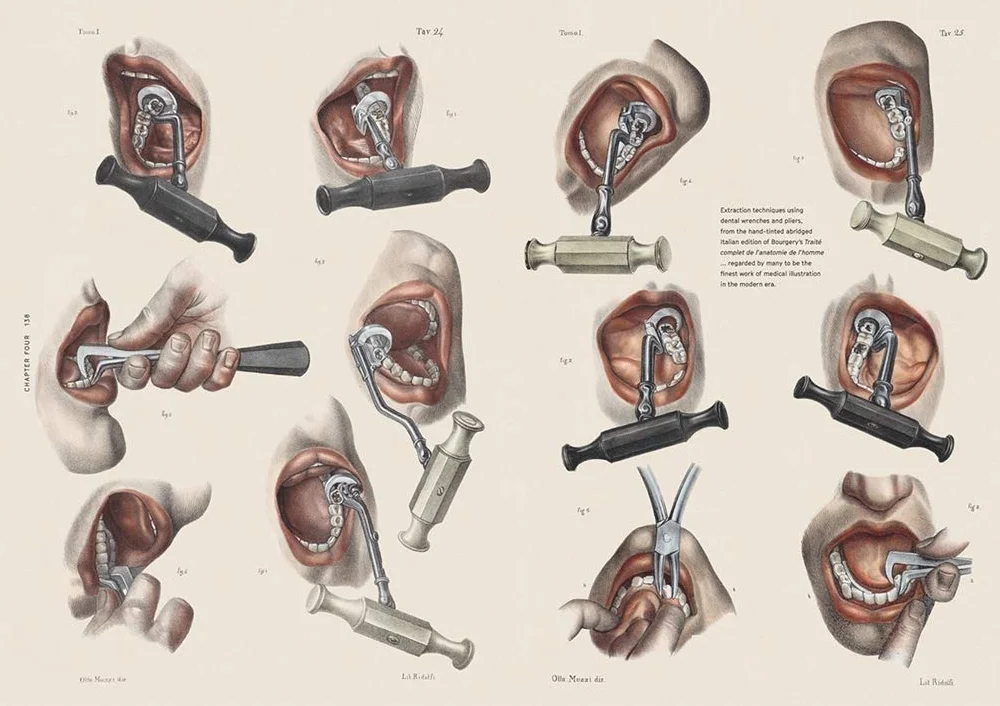 Smile Stealers: The Fine and Foul Art of Dentistry