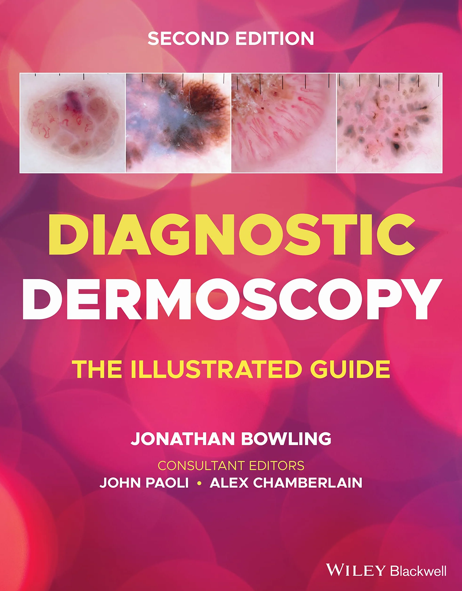 Diagnostic Dermoscopy: The Illustrated Guide
