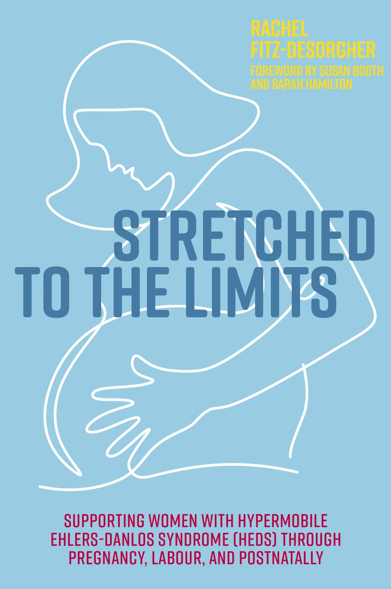 Stretched to the Limits: Supporting Women with Hypermobile Ehlers-Danlos Syndrome (Heds) Through Pregnancy, Labour, and Postnatally