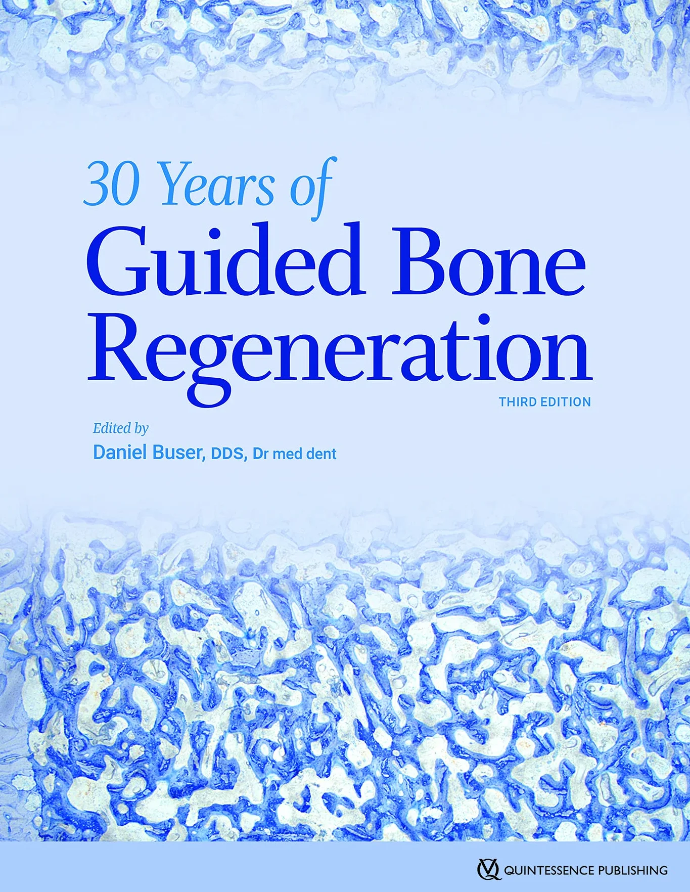 Guided Bone Regeneration 30 Years