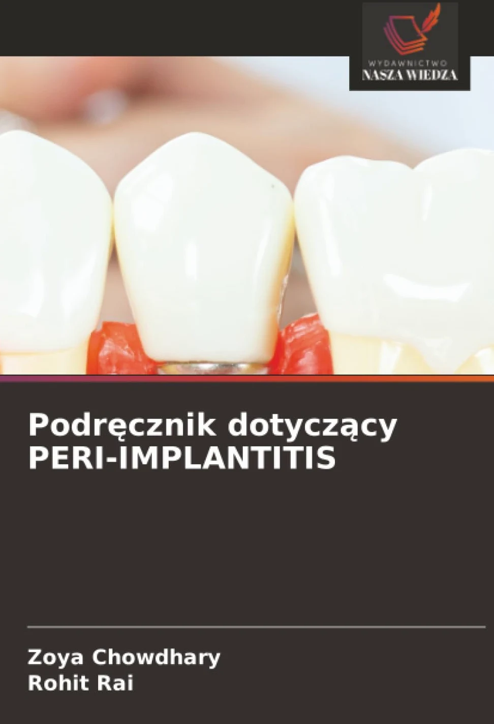 Podr¿cznik dotycz¿cy PERI-IMPLANTITIS