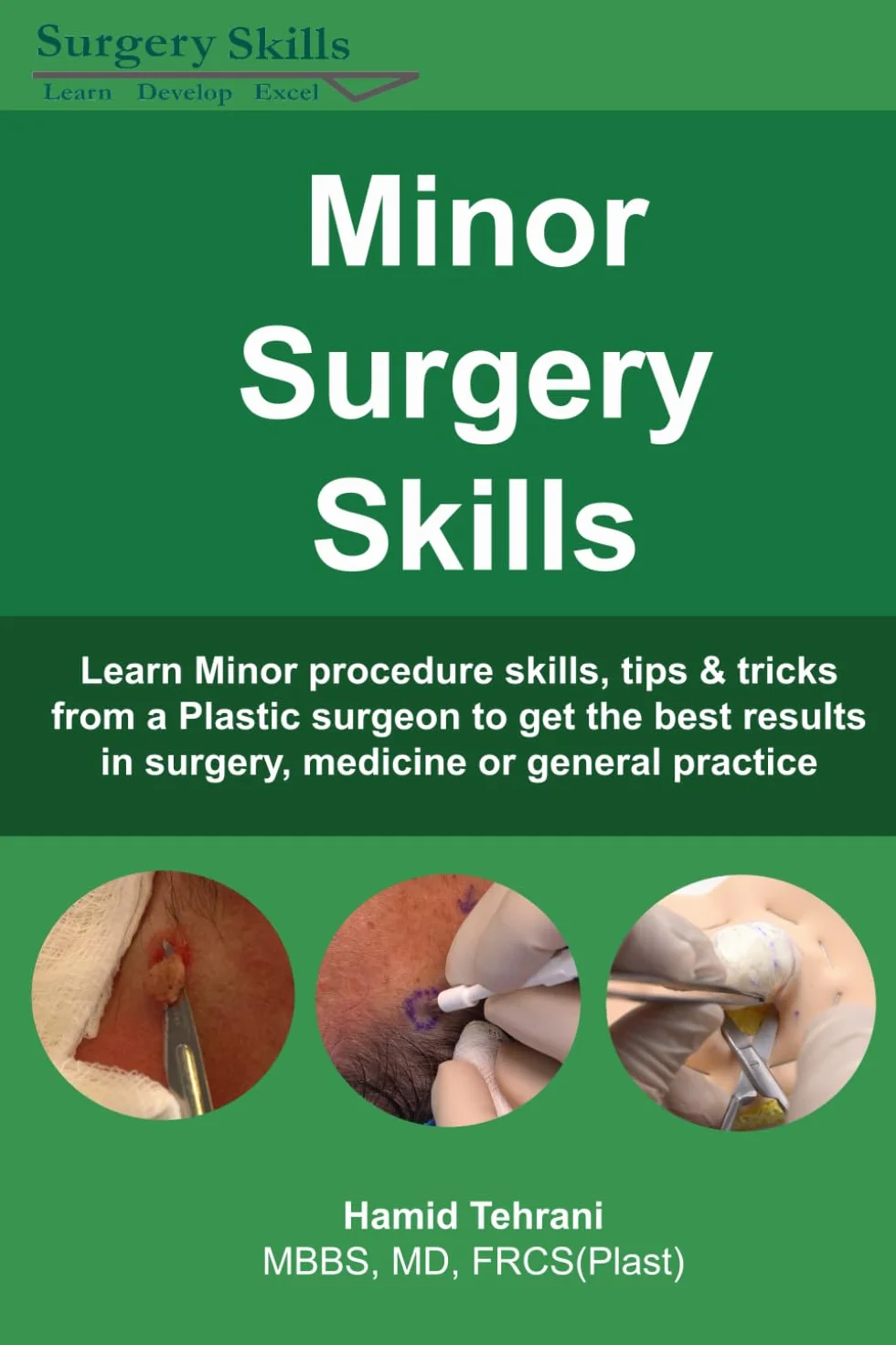 Minor Surgery Skills: Learn Procedure Tips & Tricks from a Plastic Surgeon