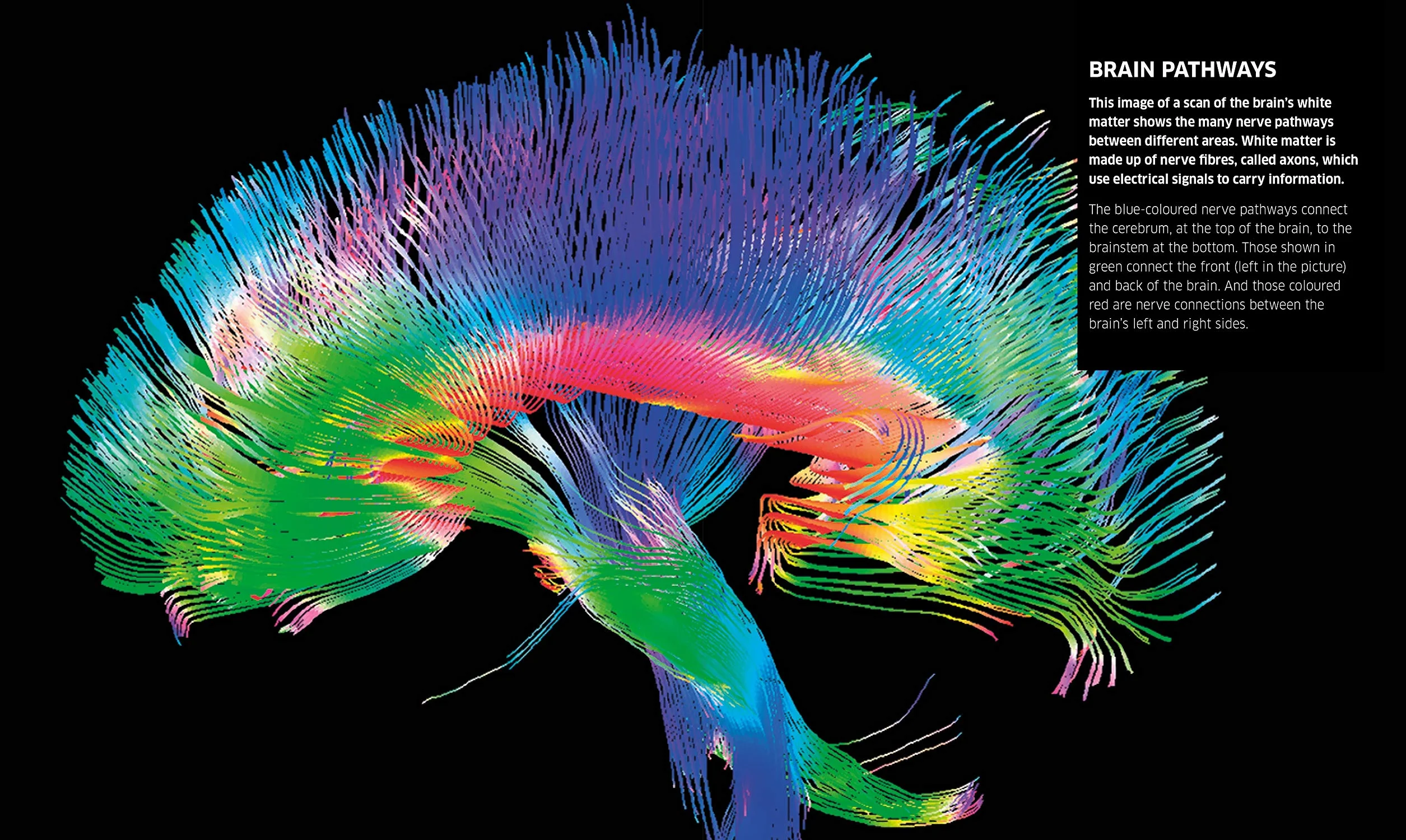 Knowledge Encyclopedia Human Body! (Knowledge Encyclopedias): Human Anatomy as You've Never Seen It Before