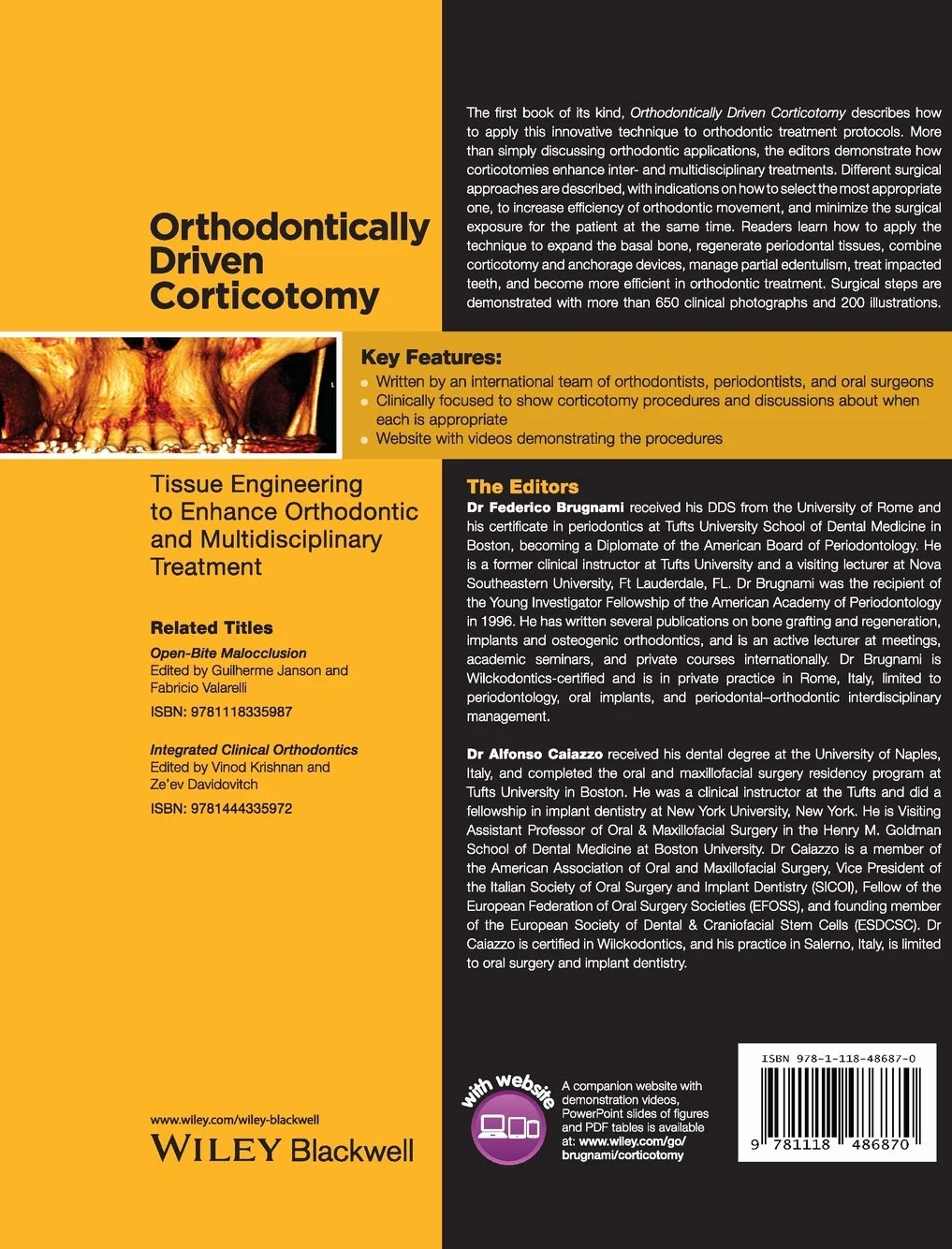 Orthodontically Driven Corticotomy: Tissue Engineering for Orthodontic and Multidisciplinary Treatment