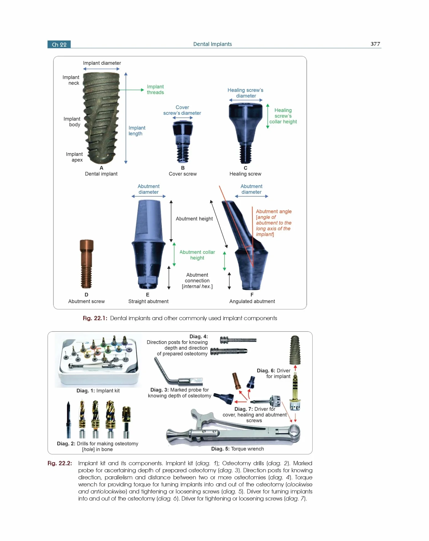 Textbook Of Periodontology For Undergraduate Students