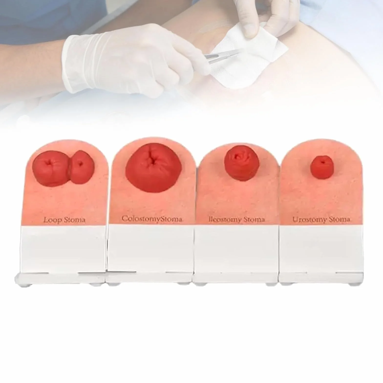 Model treningowy do pielęgnacji stomii, realistyczny symulator pielęgniarstwa stomijnego, do praktyki opieki nad ileostomią przetoki, edukacji studentów medycyny, demonstracji klinicznej, 4
