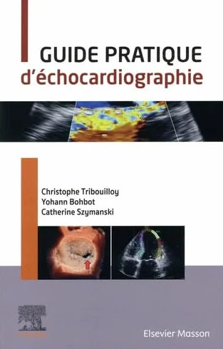 Guide pratique d'échocardiographie avec vidéos
