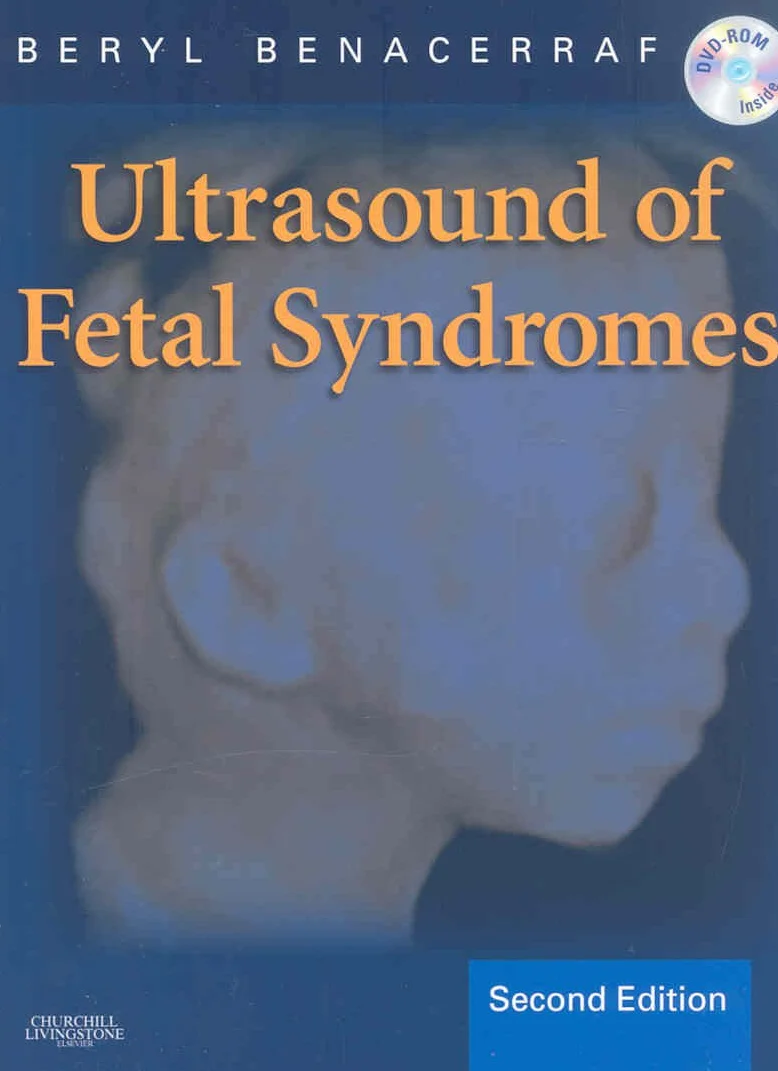 Ultrasound of Fetal Syndromes: Text with DVD