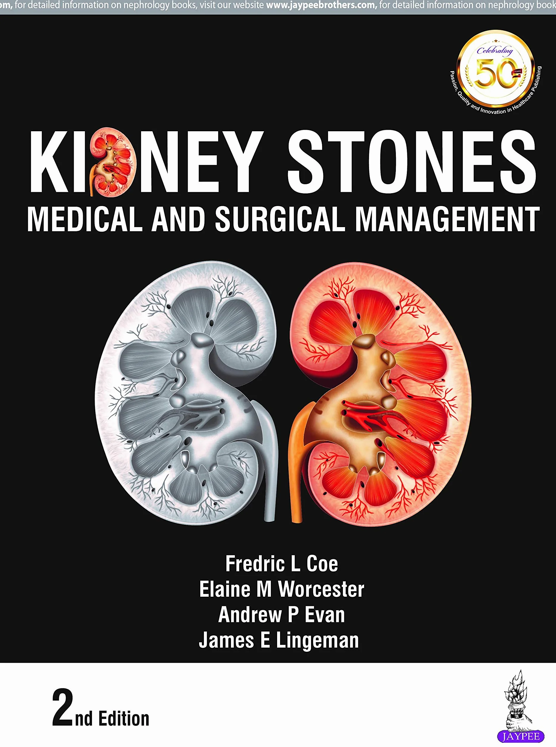 Kidney Stones: Medical and Surgical Management