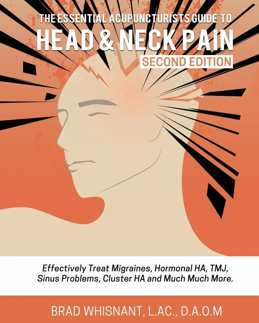 The Essential Acupuncturist Guide to Head and Neck Pain: Treat Migraines Effectively