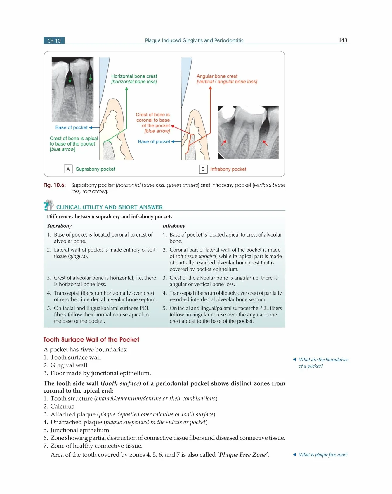 Textbook Of Periodontology For Undergraduate Students