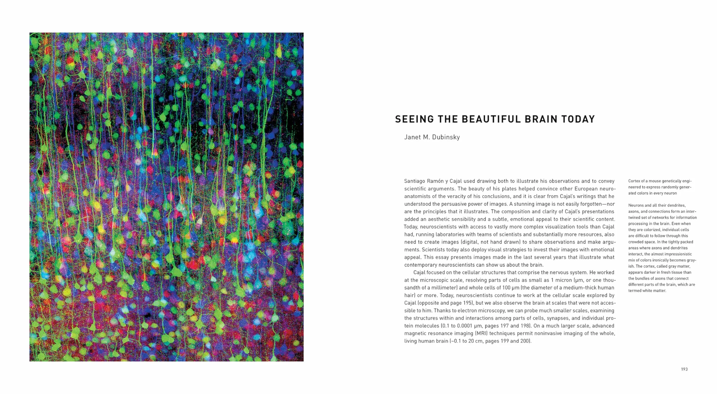 The Beautiful Brain: The Drawings of Santiago Ramon Y Cajal