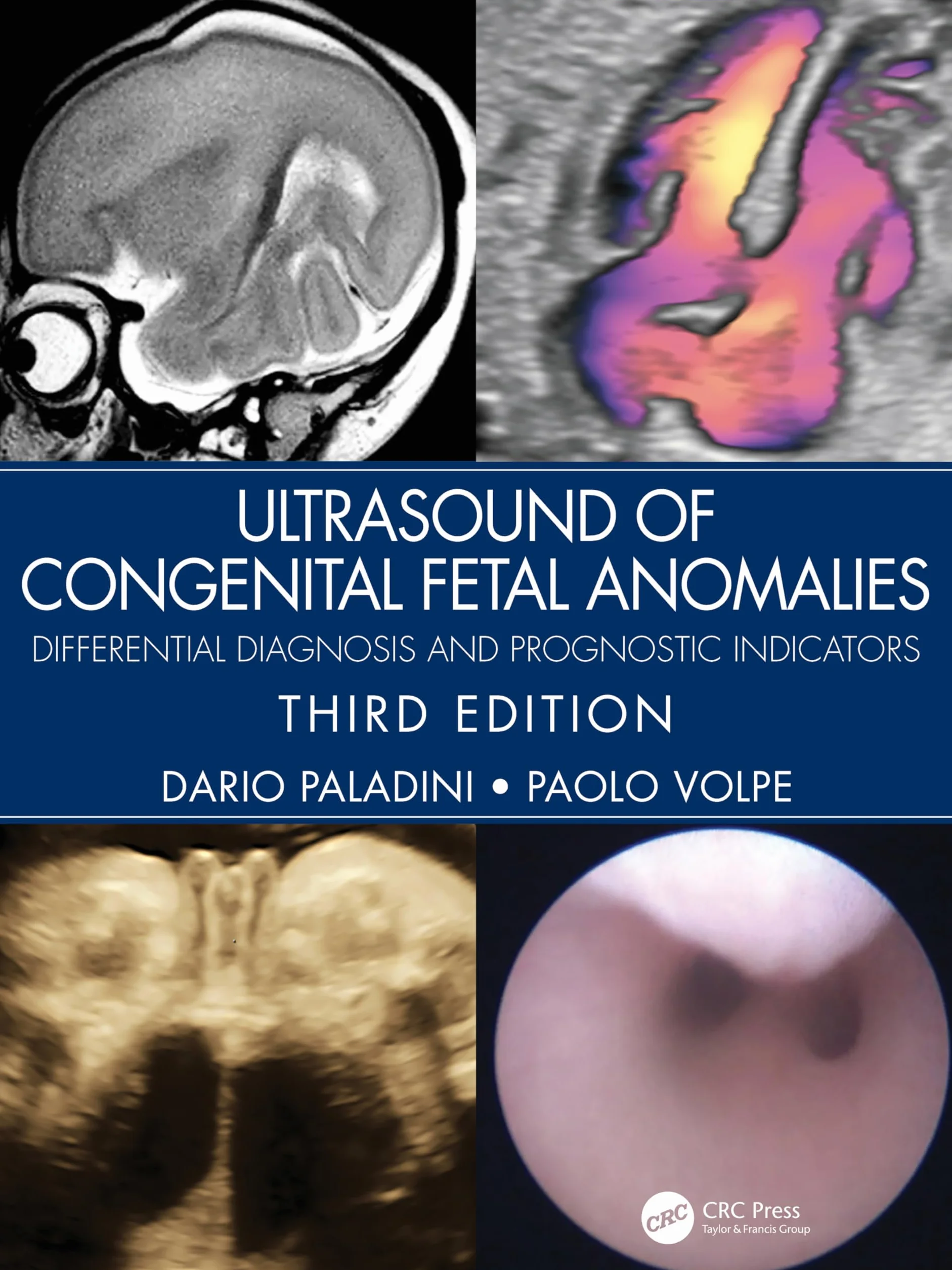 Ultrasound of Congenital Fetal Anomalies: Differential Diagnosis and Prognostic Indicators
