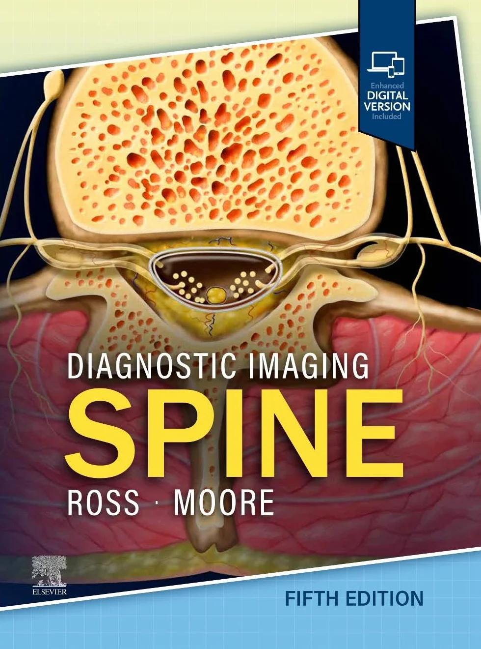 Diagnostic Imaging: Spine