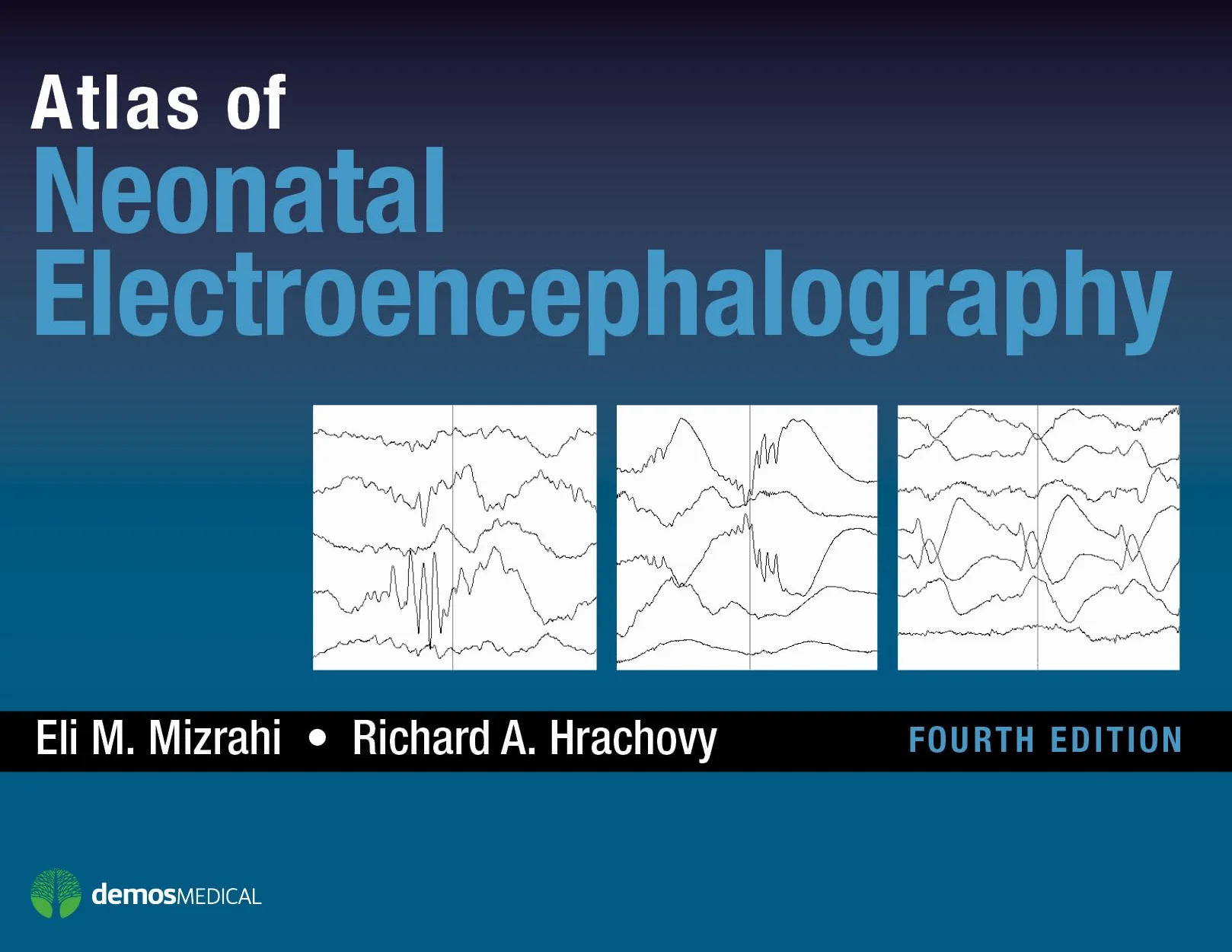 Atlas of Neonatal Electroencephalography