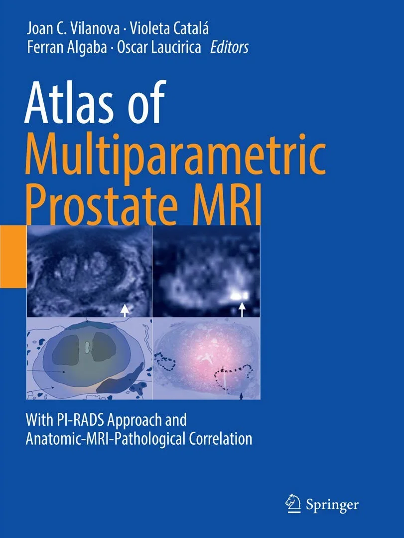 Atlas of Multiparametric Prostate MRI: PI-RADS Approach & Anatomic-MRI-Pathological Correlation