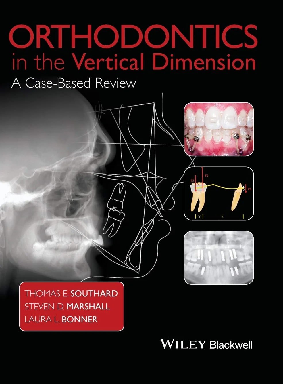 Orthodontics in the Vertical Dimension: A Case-Based Review