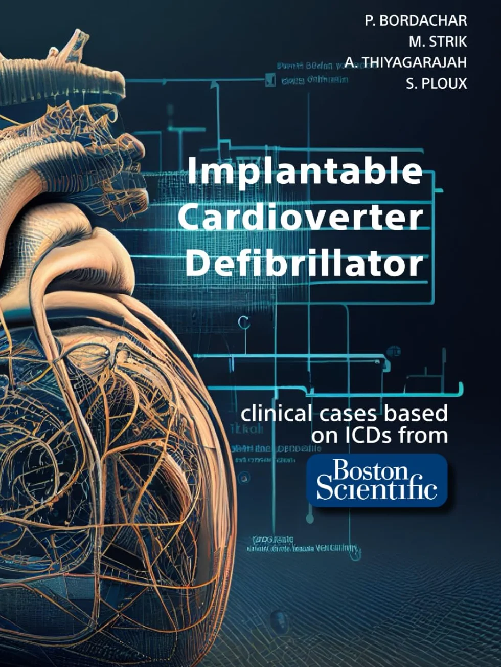 Boston Scientific Implantable Cardioverter Defibrillator ICD Clinical Cases