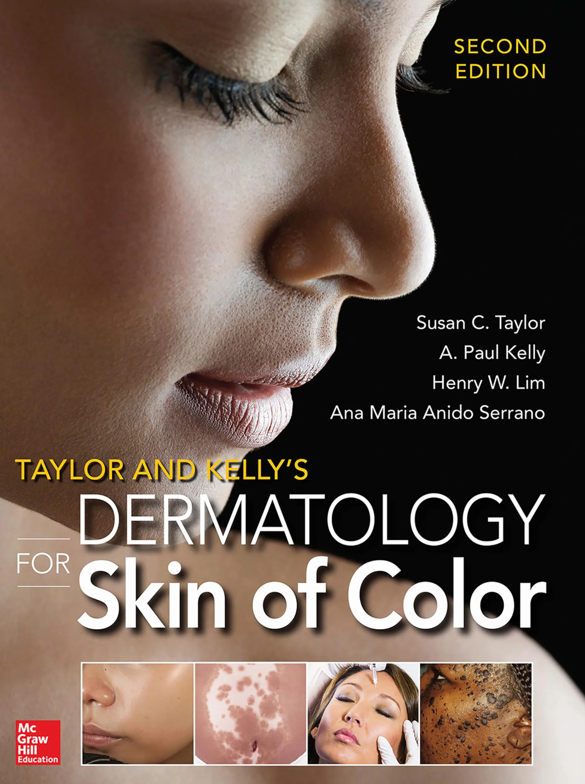 Taylor and Kelly's Dermatology for Skin of Color