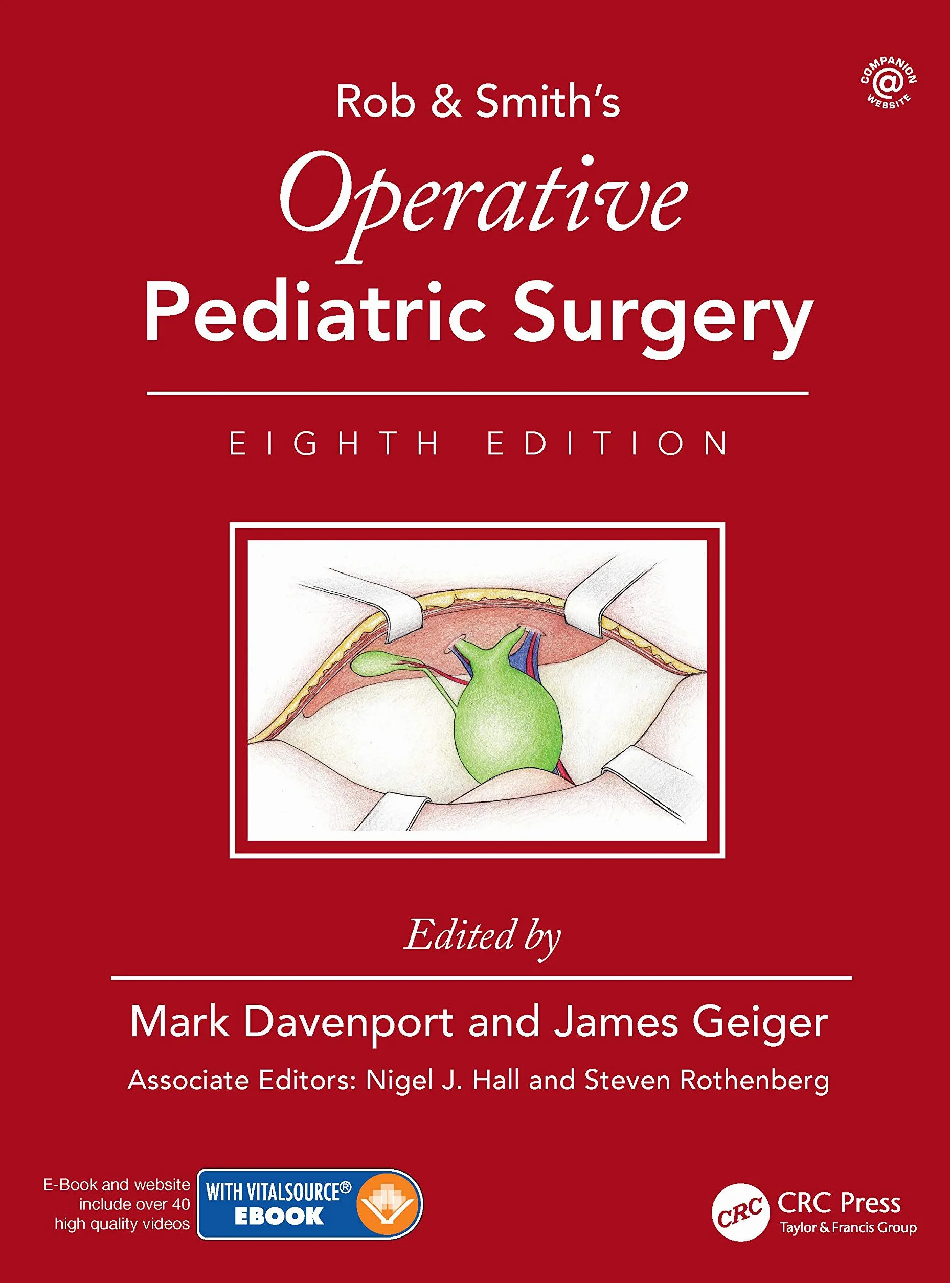 Operative Pediatric Surgery