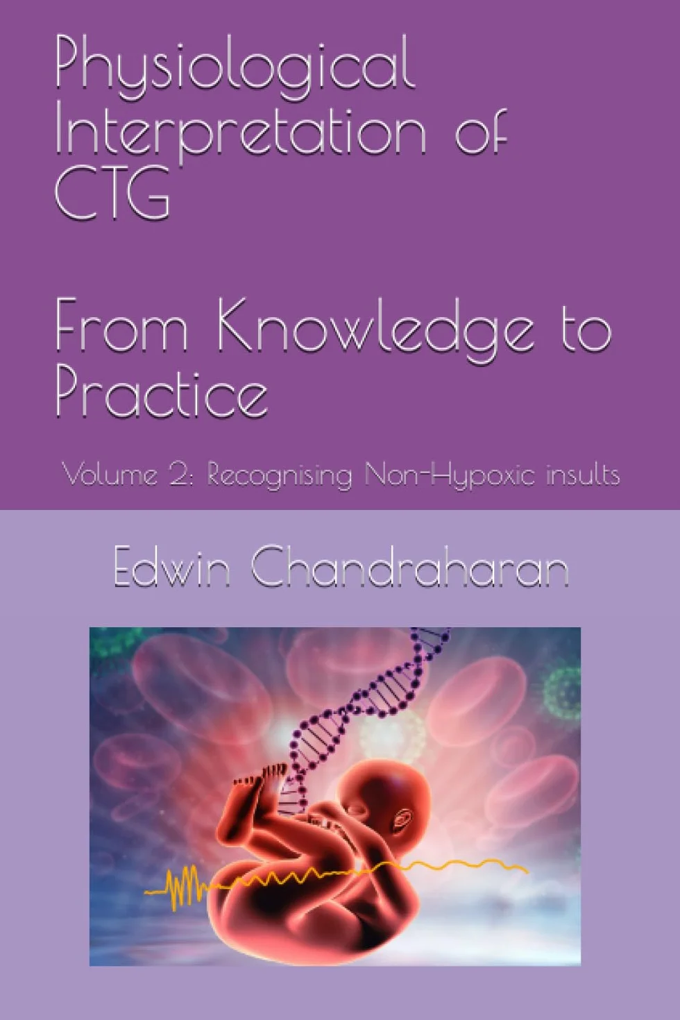 Physiological Interpretation of CTG From Knowledge to Practice: Volume 2: Recognising Non-Hypoxic insults