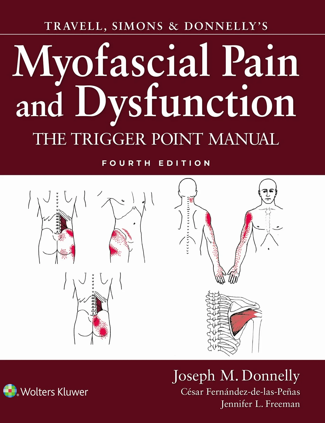 Myofascial Pain and Dysfunction: The Trigger Point Manual by Travell, Simons & Donnelly