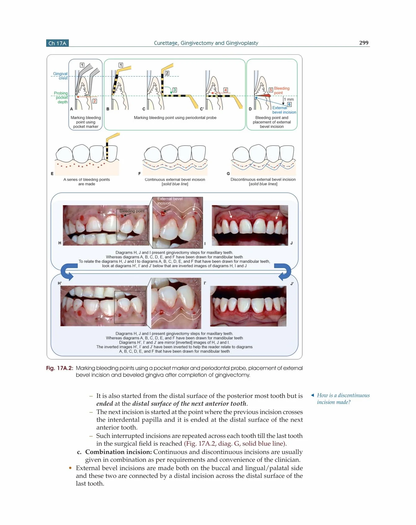 Textbook Of Periodontology For Undergraduate Students